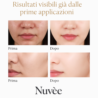 Peel Shot Glow Rice Ampoule Duo – Trattamento Illuminante Esfoliante Nuvèe