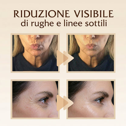 NUVÈE Patch Anti-Rughe