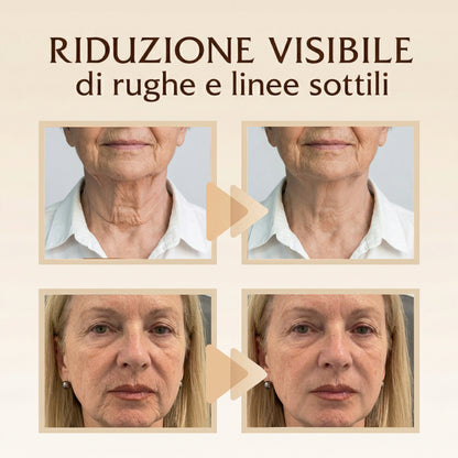 NUVÈE Patch Anti-Rughe