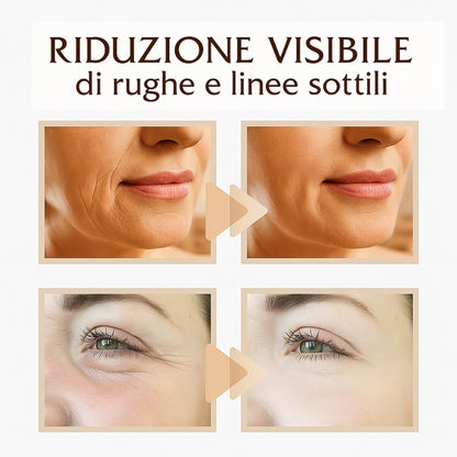 NUVÈE Patch Anti-Rughe